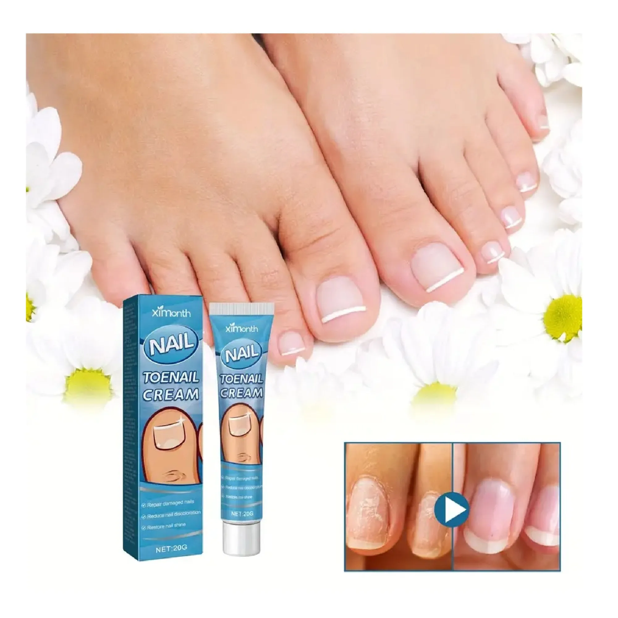 Nail Toenail Cream,Reudece Discoloration,Repair And Harden Nails,Restore Nail Shine,Keep Nails In Good Condition